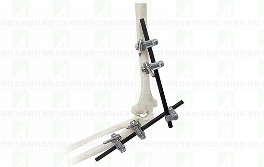 carbon-fiber-rods-ortho (1).jpg